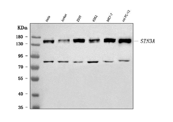 mSin3A/SIN3A Rabbit Polyclonal Antibody