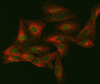 mSin3A/SIN3A Rabbit Polyclonal Antibody