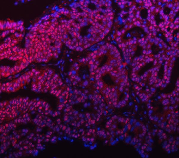mSin3A/SIN3A Rabbit Polyclonal Antibody