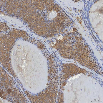 mSin3A/SIN3A Rabbit Polyclonal Antibody