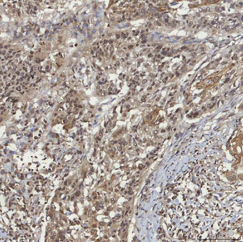 mSin3A/SIN3A Rabbit Polyclonal Antibody