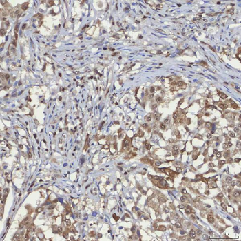 mSin3A/SIN3A Rabbit Polyclonal Antibody