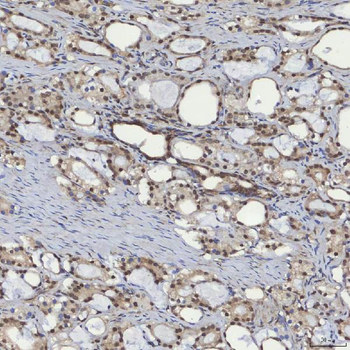 mSin3A/SIN3A Rabbit Polyclonal Antibody
