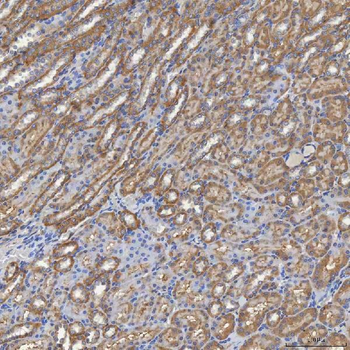 SHQ1 Rabbit Polyclonal Antibody