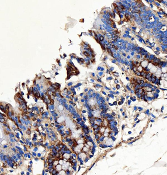SH2D4A Rabbit Polyclonal Antibody