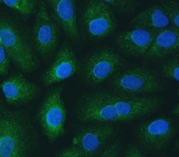 SH2D4A Rabbit Polyclonal Antibody