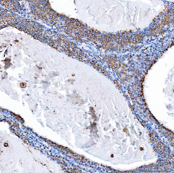 SH2D4A Rabbit Polyclonal Antibody