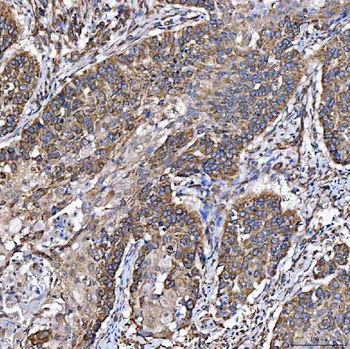 SH2D4A Rabbit Polyclonal Antibody