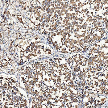 SH2D4A Rabbit Polyclonal Antibody