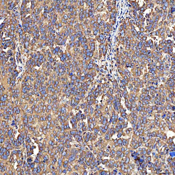 SH2D4A Rabbit Polyclonal Antibody