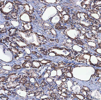 SH2D4A Rabbit Polyclonal Antibody