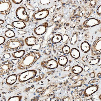 SH2D4A Rabbit Polyclonal Antibody