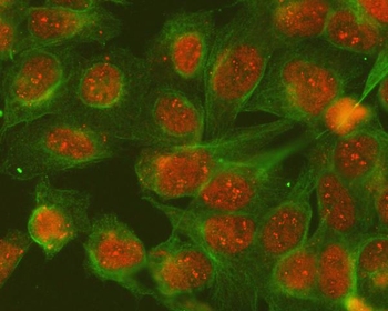 SGTA Rabbit Polyclonal Antibody