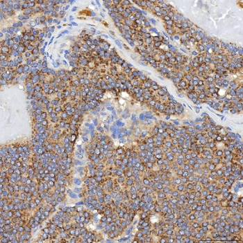 SGCE Rabbit Polyclonal Antibody