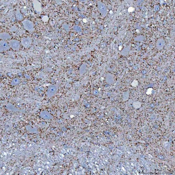 SFXN5 Rabbit Polyclonal Antibody