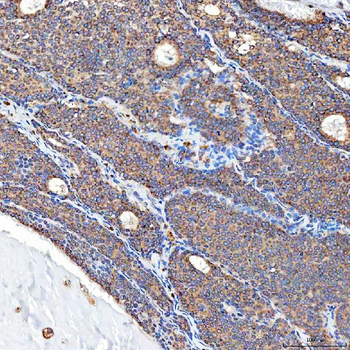 SFXN5 Rabbit Polyclonal Antibody