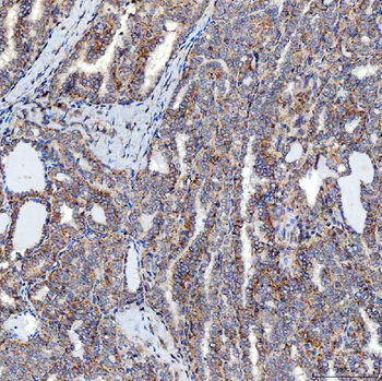 SFXN5 Rabbit Polyclonal Antibody