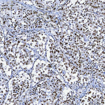 SF3B3 Rabbit Polyclonal Antibody