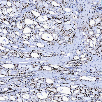 SF3B3 Rabbit Polyclonal Antibody
