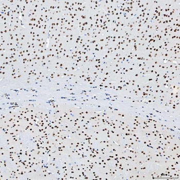 SF3B3 Rabbit Polyclonal Antibody