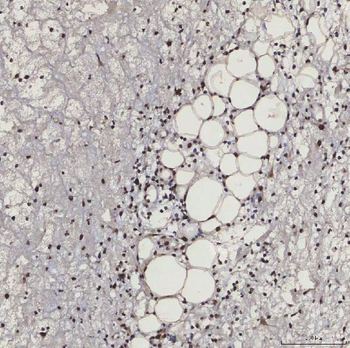 SF3B3 Rabbit Polyclonal Antibody