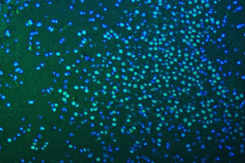 SF3B3 Rabbit Polyclonal Antibody