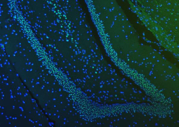 SF3B3 Rabbit Polyclonal Antibody