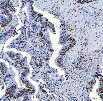 SF3B3 Rabbit Polyclonal Antibody