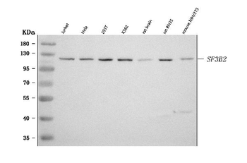 SF3B2 Rabbit Polyclonal Antibody
