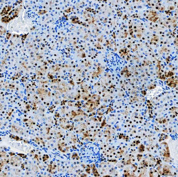 SF3A3 Rabbit Polyclonal Antibody