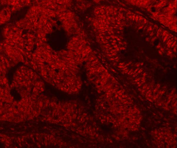 SF3A3 Rabbit Polyclonal Antibody