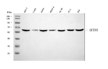 SETD3 Rabbit Polyclonal Antibody