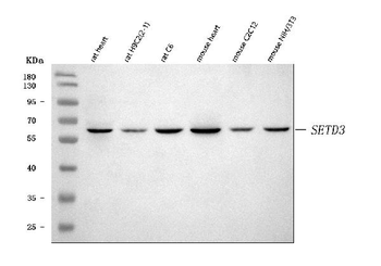 SETD3 Rabbit Polyclonal Antibody