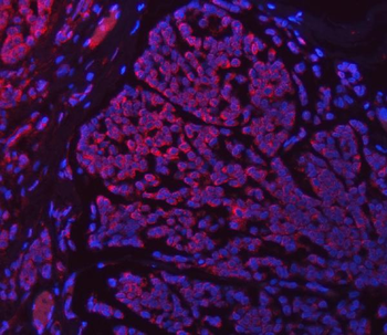 SETD3 Rabbit Polyclonal Antibody