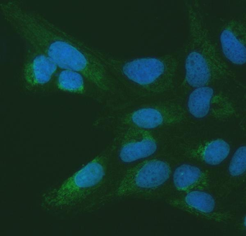 SETD3 Rabbit Polyclonal Antibody