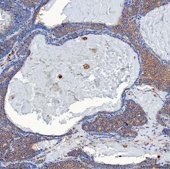 SETD3 Rabbit Polyclonal Antibody