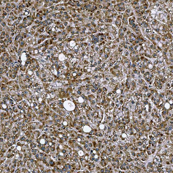 SETD3 Rabbit Polyclonal Antibody