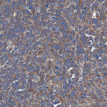 SETD3 Rabbit Polyclonal Antibody