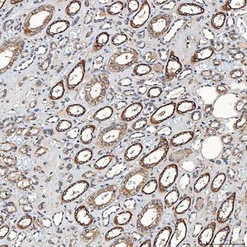 SETD3 Rabbit Polyclonal Antibody