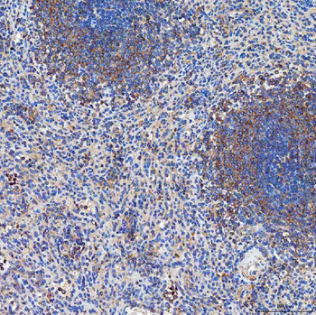 SETD3 Rabbit Polyclonal Antibody
