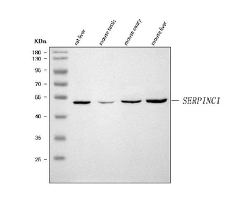 Antithrombin III/SERPINC1 Rabbit Polyclonal Antibody