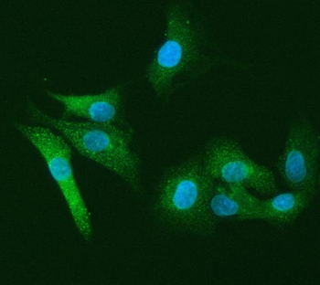 PI2/SERPINB1 Rabbit Polyclonal Antibody