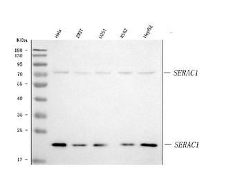SERAC1 Rabbit Polyclonal Antibody