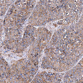 SERAC1 Rabbit Polyclonal Antibody
