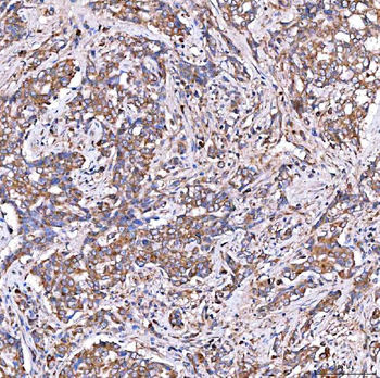 SERAC1 Rabbit Polyclonal Antibody