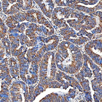 SERAC1 Rabbit Polyclonal Antibody