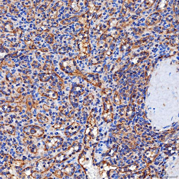 SERAC1 Rabbit Polyclonal Antibody