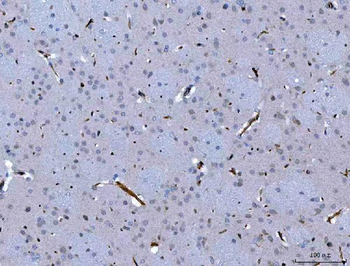 SEMA4F Rabbit Polyclonal Antibody