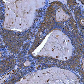SEMA4F Rabbit Polyclonal Antibody
