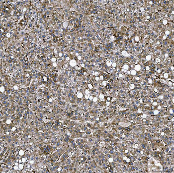 SEMA4F Rabbit Polyclonal Antibody